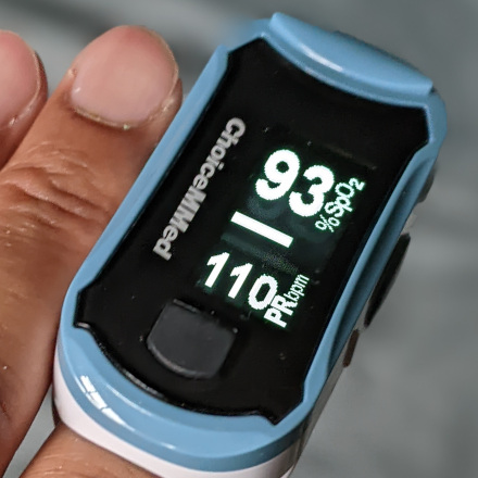 Pulse oximeter on finger, reading of 93% SpO2 and 110 bpm pulse rate